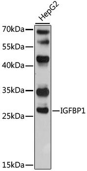 Anti-IGFBP1 Antibody (CAB2981)