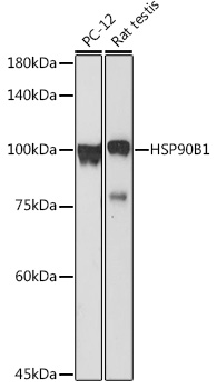 Anti-HSP90B1 Antibody (CAB6272)