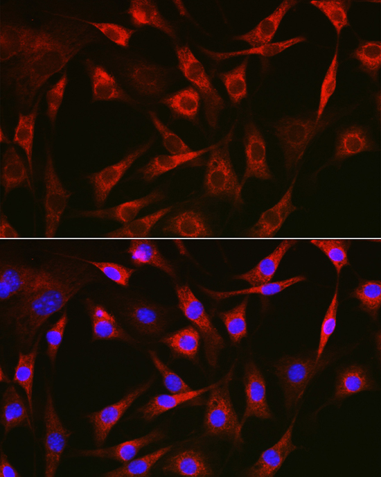 Anti-FAK Antibody (CAB11531)