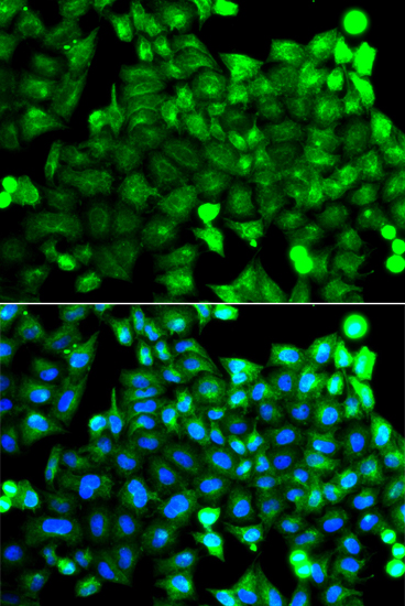 Anti-Neurocalcin-delta Polyclonal Antibody (CAB8000)