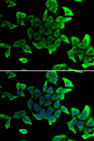 Anti-SGCD Antibody (CAB13351)