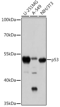 Anti-p53 Antibody (CAB16989)