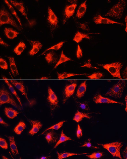 Anti-FXR1 Antibody (CAB5942)