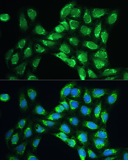 Anti-PRDX5 Antibody (CAB6329)