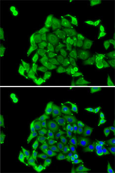 Anti-RPS14 Antibody (CAB6727)