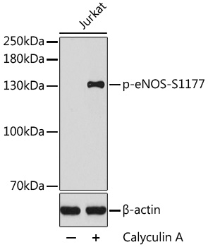 Anti-Phospho-NOS3-S1177 Antibody (CABP0421)