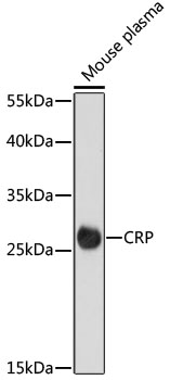 Anti-CRP Antibody (CAB15659)