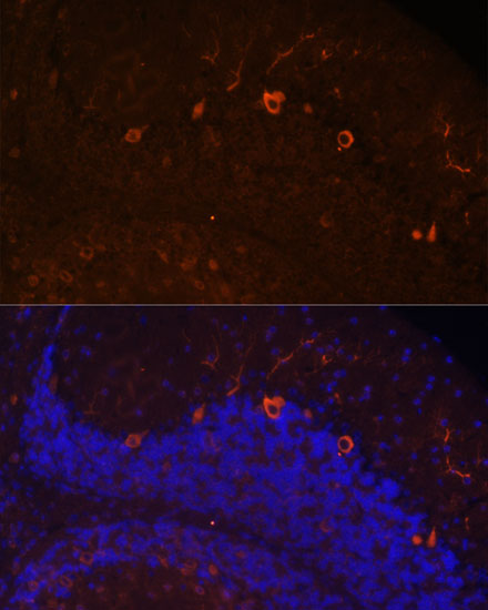 Anti-KAL1 Antibody (CAB16389)