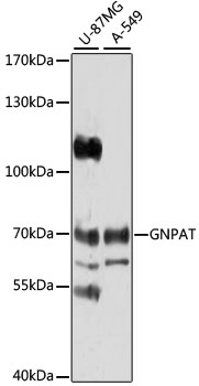 Anti-GNPAT Antibody (CAB4220)