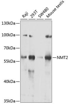 Anti-NMT2 Antibody (CAB7042)