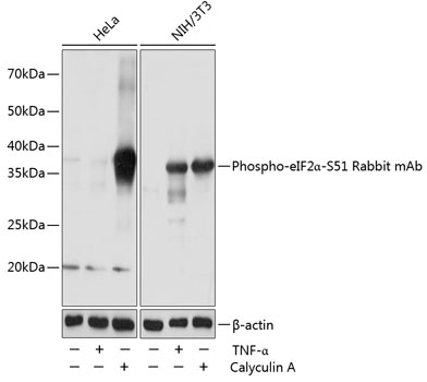 Anti-Phospho-eIF2Alpha-S51 Antibody (CABP0692)