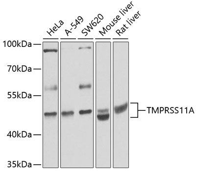 Anti-TMPRSS11A Polyclonal Antibody (CAB8605)