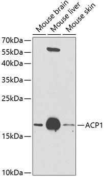 Anti-ACP1 Antibody (CAB1801)