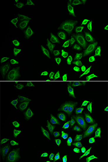 Anti-PLA2G2D Antibody (CAB7165)