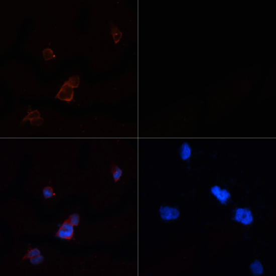 Anti-acetyl-ACC1 Antibody (CAB15606)