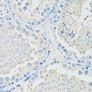 Anti-SLC2A9 Antibody (CAB14606)