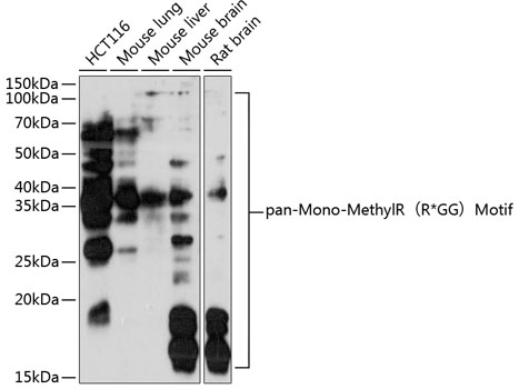 pan-Mono-MethylR R*GG Motif Rabbit Polyclonal Antibody (CAB18297)