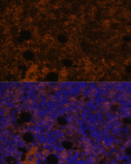 Anti-CD11B Antibody (CAB1581)