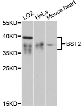 Anti-BST2 Antibody (CAB12315)