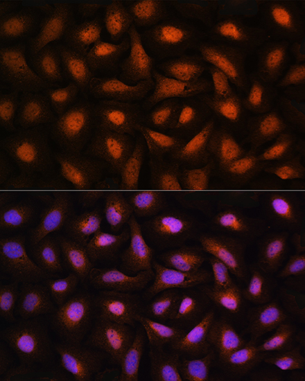 Anti-CTBP2 Antibody (CAB2257)