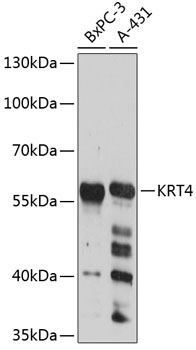 Anti-KRT4 Antibody (CAB12156)