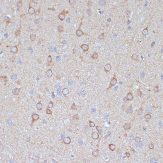 Anti-COPG2 Antibody (CAB15816)