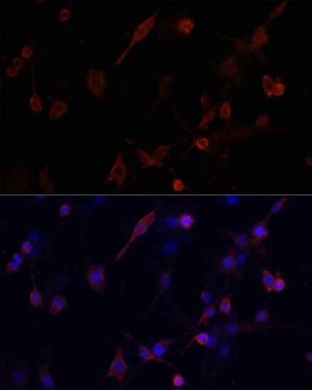 Anti-CFL1 Antibody (CAB1704)