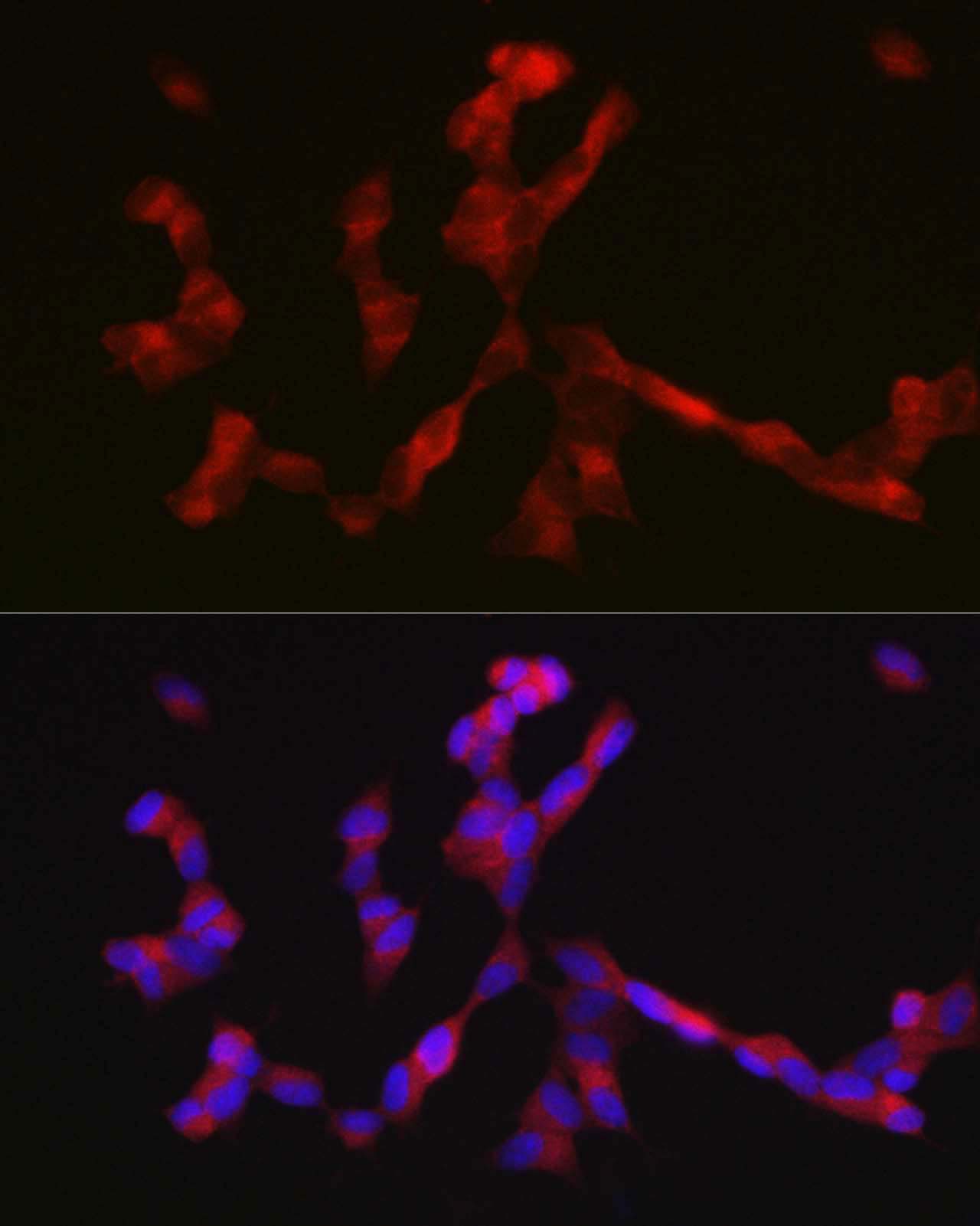 Anti-ALK Antibody (CAB0766)