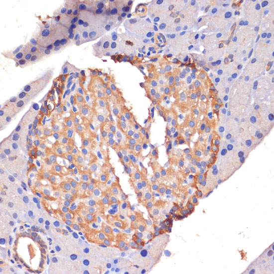 Anti-STING / TMEM173 Antibody (CAB3575)