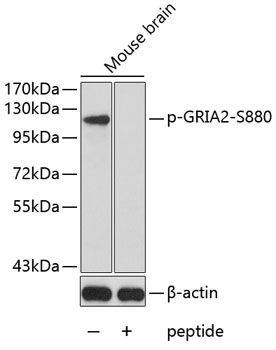 Anti-Phospho-GRIA2-S880 Antibody (CABP0257)