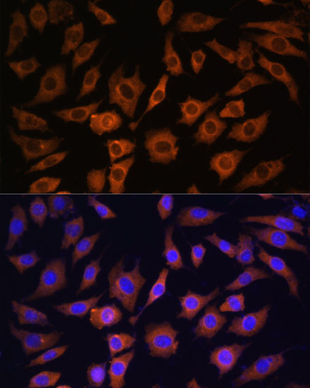 Anti-YWHAB Antibody (CAB1023)