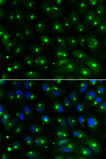 Anti-GGA2 Antibody (CAB1186)