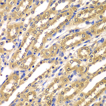 Anti-UBA3 Antibody (CAB7504)