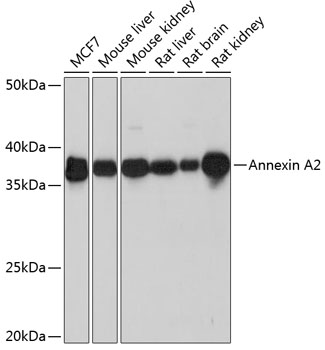 Anti-Annexin A2 Antibody