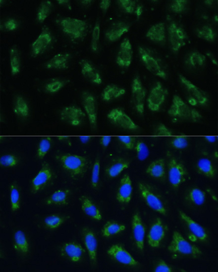 Anti-APOB Antibody (CAB1330)