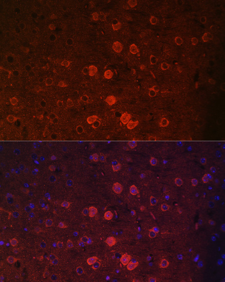 Anti-TRPM2 Antibody (CAB6137)