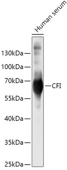 Anti-CFI Antibody (CAB5623)