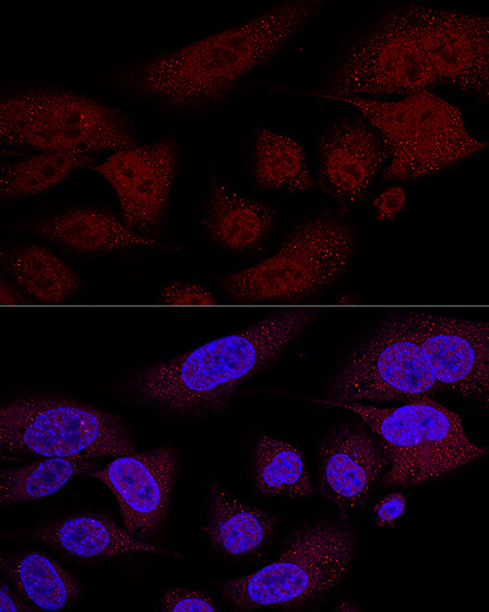 Anti-TAZ Polyclonal Antibody (CAB8202)