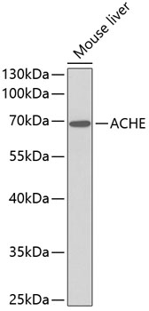 Anti-ACHE Antibody (CAB1454)