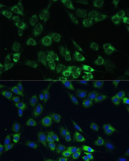 Anti-USP46 Antibody (CAB17863)