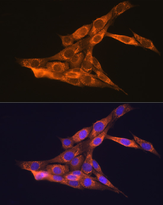 Anti-VEGFB Antibody (CAB2132)