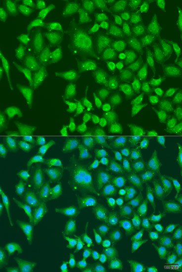 Anti-CENPQ Antibody (CAB7628)