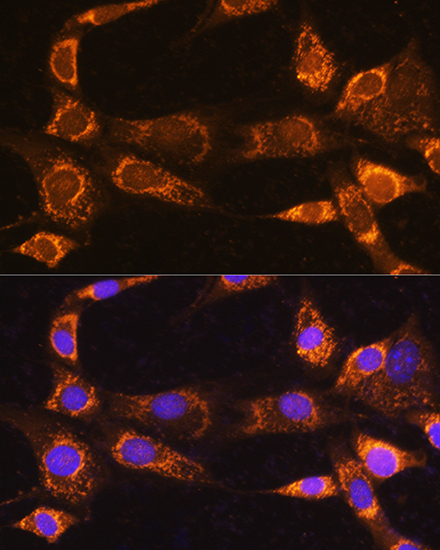 Anti-RABL3 Antibody (CAB14327)