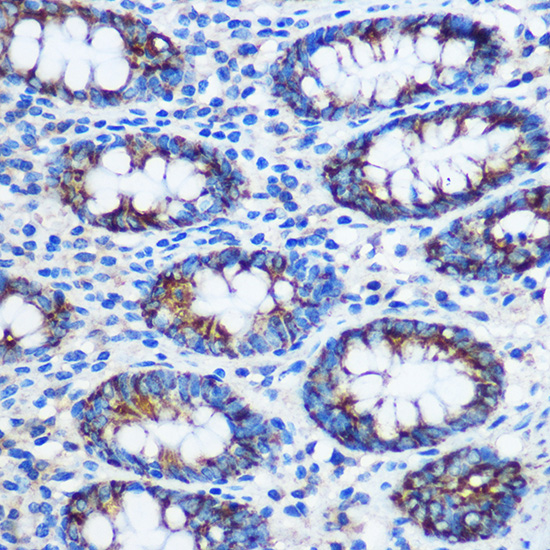 Anti-TGOLN2 Antibody (CAB16707)