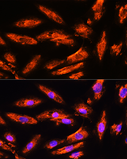 Anti-BNP Antibody (CAB2179)