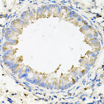 Anti-CALU Antibody (CAB6538)