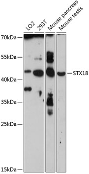 Anti-STX18 Antibody (CAB14368)