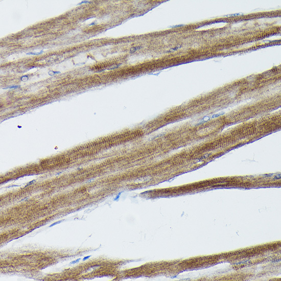 Anti-SOCS3 Antibody (CAB0694)