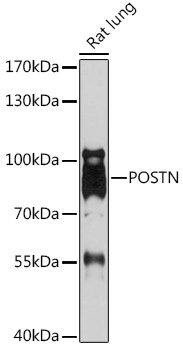 Anti-POSTN Antibody (CAB14556)