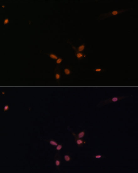 Anti-Smad7 Antibody (CAB16396)